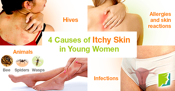 4 Causes of Itchy Skin in Young Women